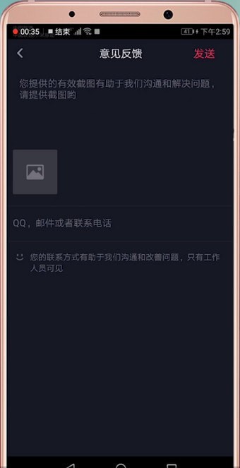 在抖音里怎么聯系客服？聯系客服的方法說明