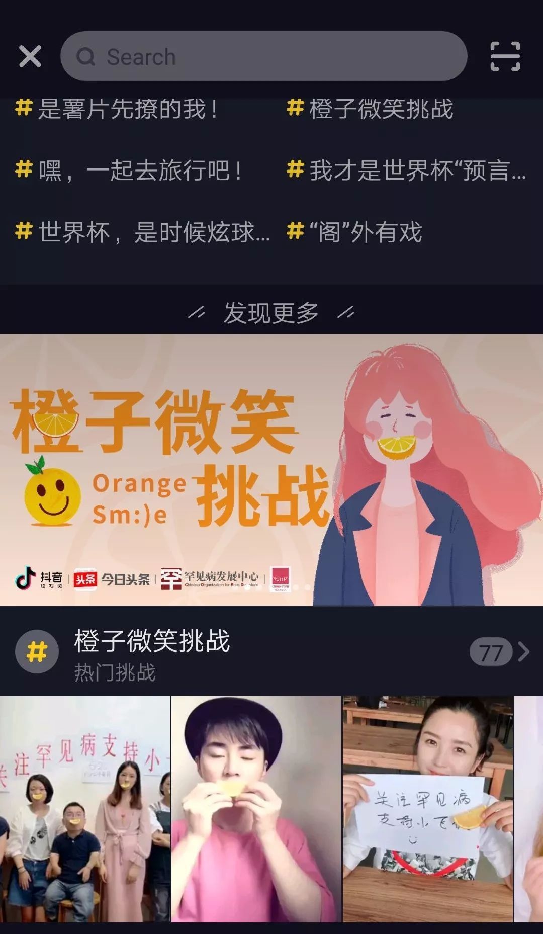 【抖音小飛俠是什么意思】小飛俠是什么病？橙子微笑挑戰如何參加